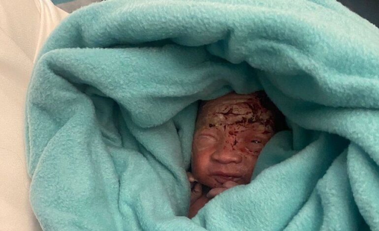 NEWBORN BABY ABANDONED IN AIR MAURITIUS PLANE TOILET BIN