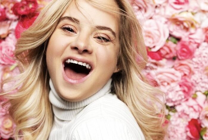 VICTORIA’S SECRET SIGNS FIRST DOWN’S SYNDROME MODEL
