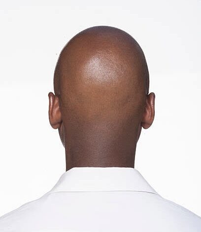 CALLING A MAN ‘BALD’ IS SEXUAL HARASSMENT, COURT RULES