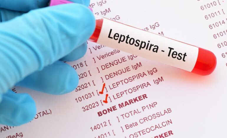 LEPTOSPIROSIS EPIDEMIC CONFIRMED IN TANZANIA