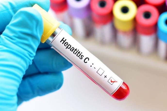 ‘HEPATITIS C’ CAMPAIGN LAUNCHED BY GUYANA